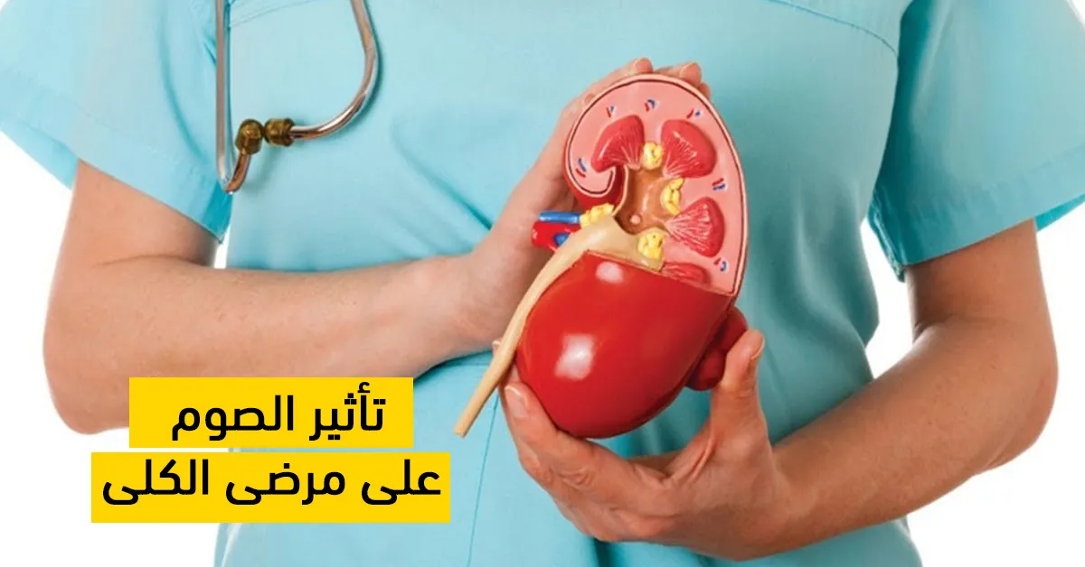 تأثير الصوم على مرضى الكلى